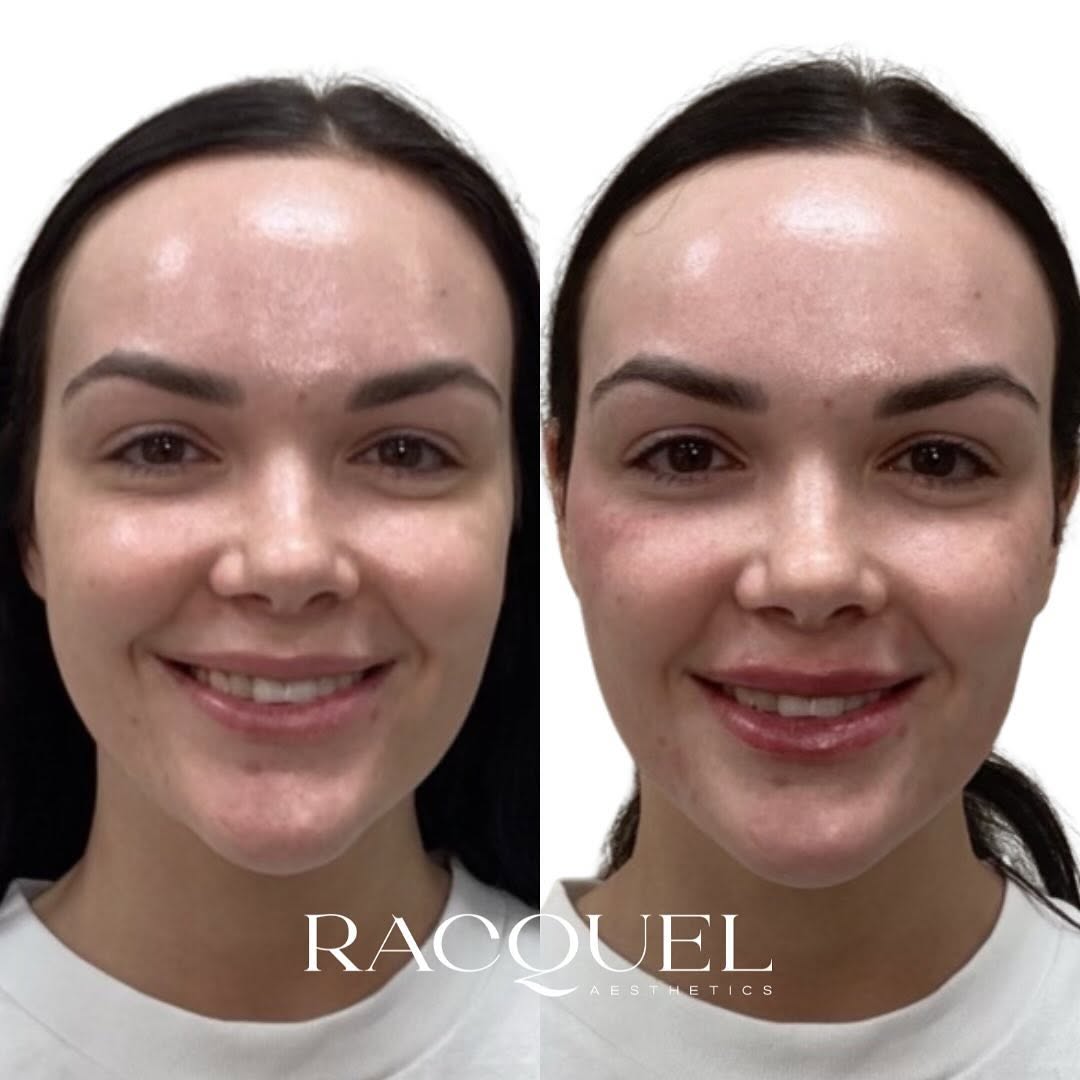 Visible pigmentation improvement